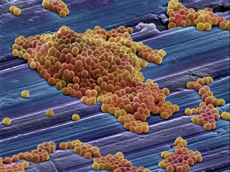 Illustration for article titled Can We Avoid an Antibiotic Apocalypse?